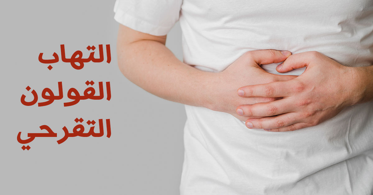التهاب-القولون-التقرحي-Ulcerative-colitis.jpg