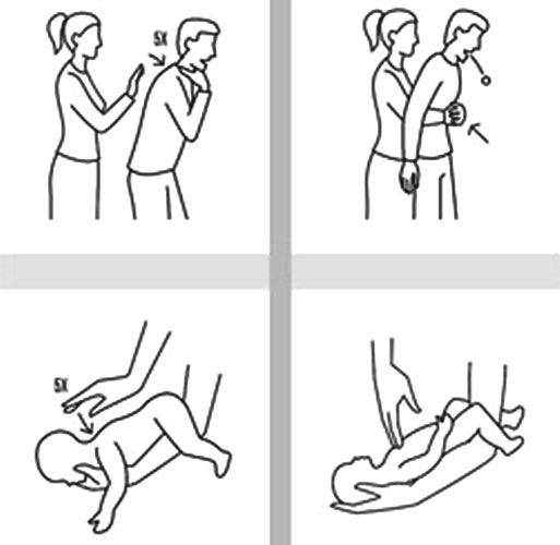 first-aid-for-choking.jpg