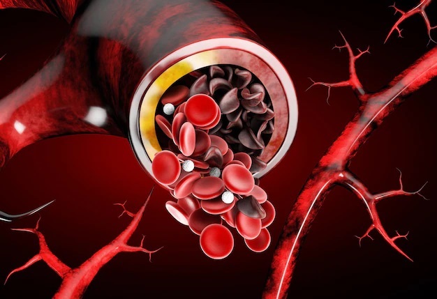 Sickle Cell Disease.jpg