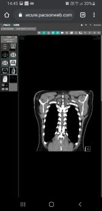 Screenshot_20200723-144535_Chrome.jpg