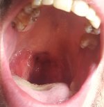 20201107_114317.jpg