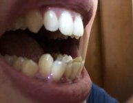 teeth.jpg