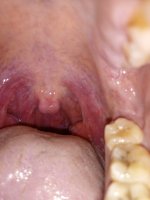 IMG_20220306_084522.jpg