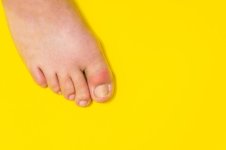 Gout.jpg Gout.jpg