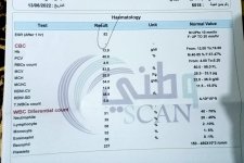 IMG_٢٠٢٢٠٦١٦_٢١٢٤٢٥.jpg