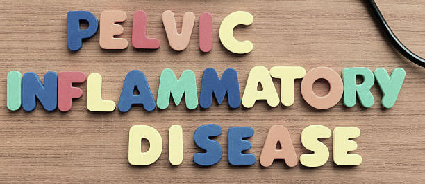 المرض الالتهابي الحوضي | التهاب الحوض Pelvic Inflammatory Disease PID