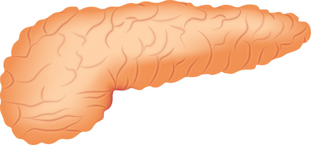 سرطان البنكرياس Pancreatic cancer