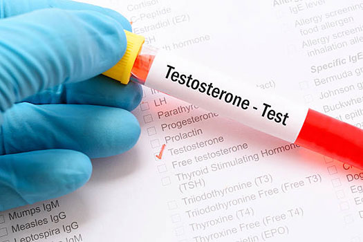 تحليل هرمون التستوستيرون هرمون الذكورة Testosterone طبيب