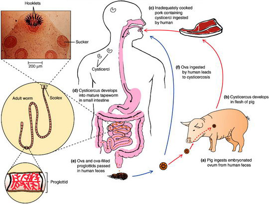 الدودة الشريطية | الشريطيات | Tapeworms