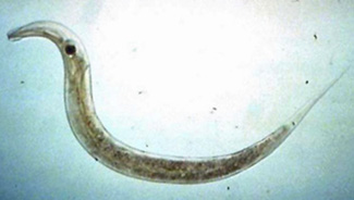 الديدان الدبوسية Pinworms