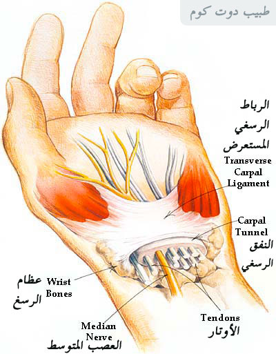 اوجاع وتنميل اليد | متلازمة النفق الرسغي carpal tunnel syndrome