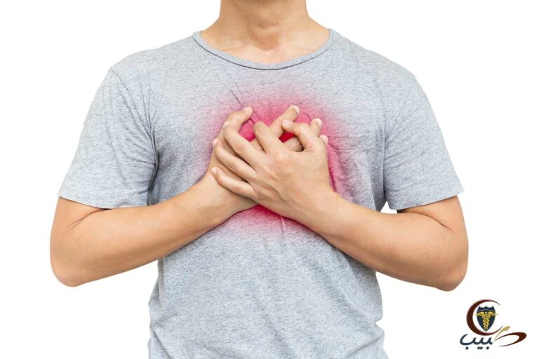 الارتجاع المعدي المريئي Gastroesophageal Reflux Disease