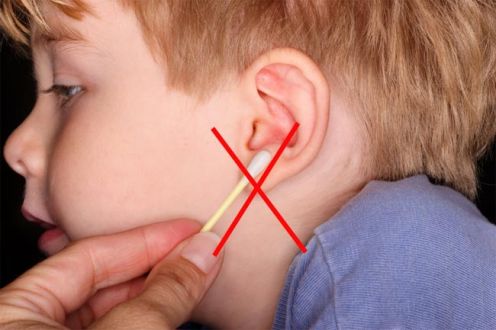 شمع الأذن Earwax : إفراز طبيعي ووظيفة وقائية
