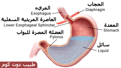 حرقة المعدة