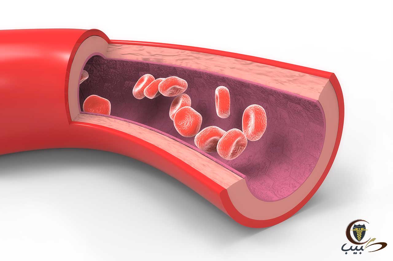 ‏ارتفاع الكولسترول High cholesterol