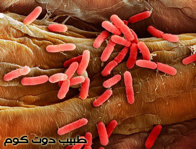 التهاب المسالك البولية عند المرأة Urinary Tract Infections طبيب دوت كوم