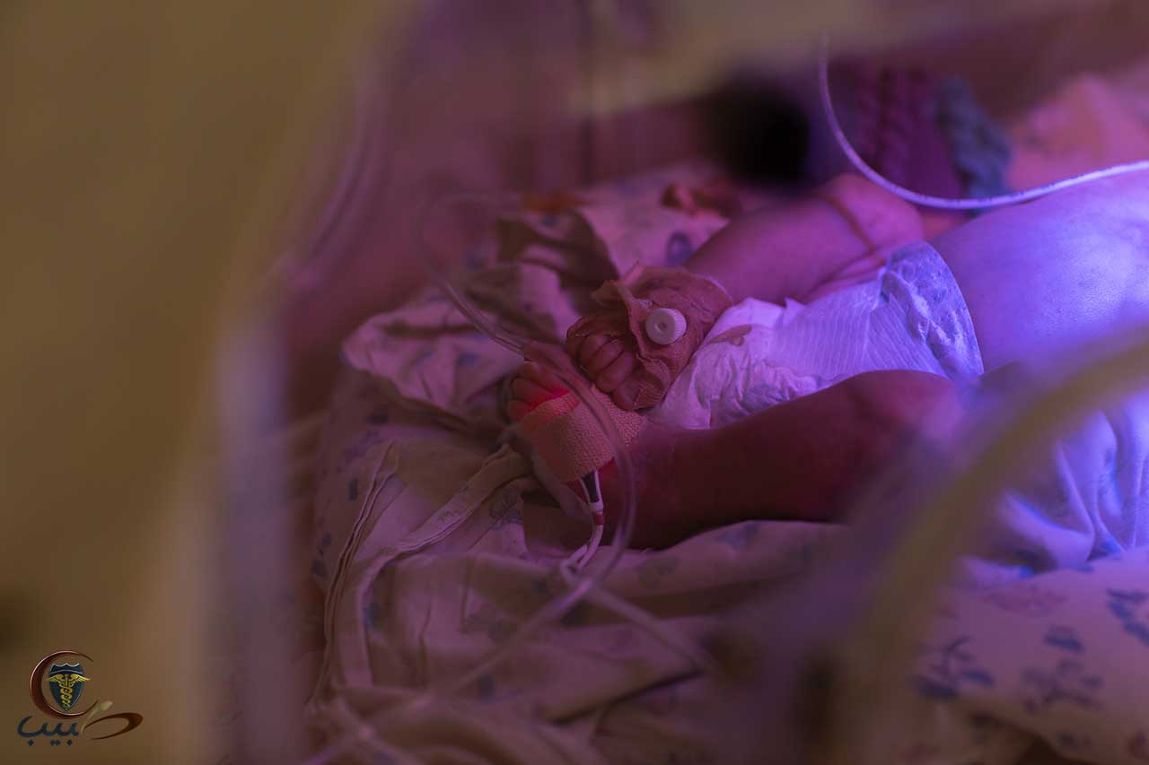 الولادة المبكرة، الطفل الخديج Premature birth - premature baby