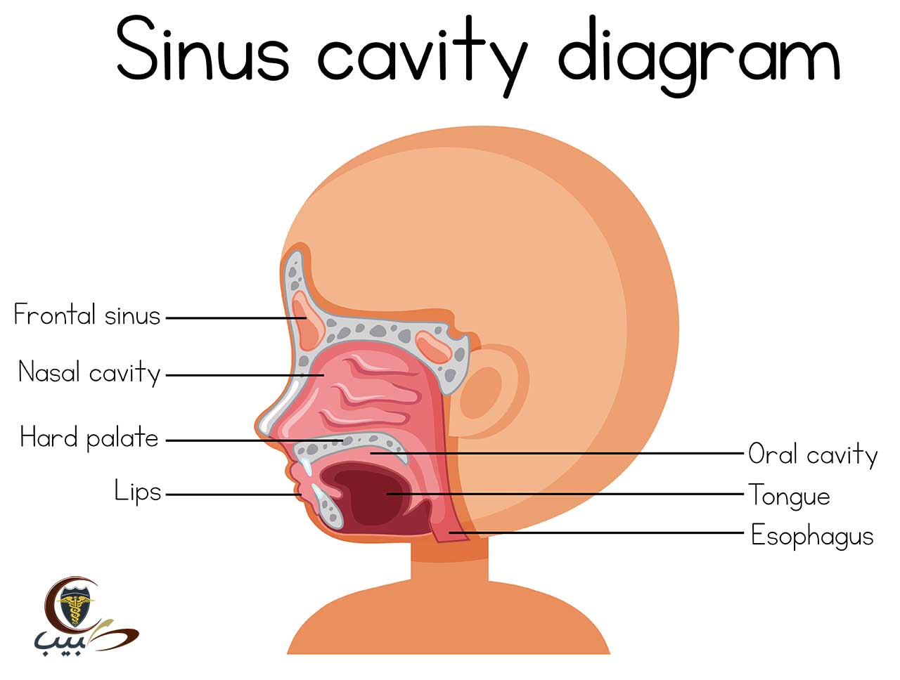 التهاب الجيوب الأنفية عند الأطفال sinusitis