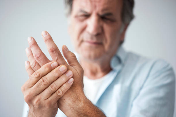 ما هو التهاب المفاصل الروماتويدي (الروماتويد) Rheumatoid Arthritis