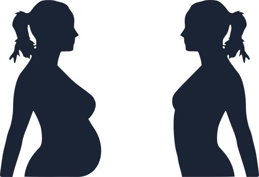 الحمل بعد جراحات إنقاص الوزن