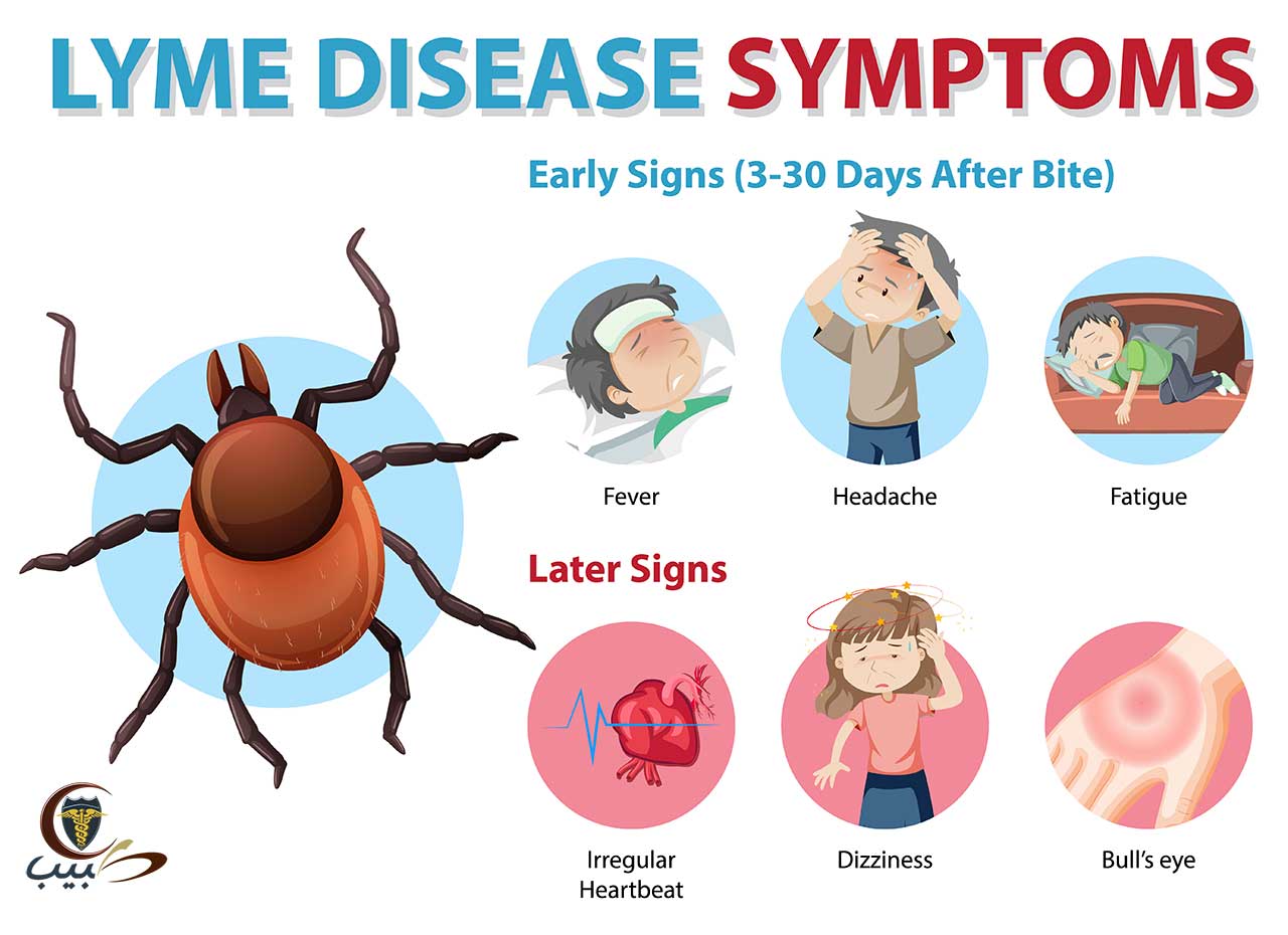 مرض لايم أثناء الحمل Lyme