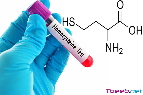 الهوموسيستين Homocysteine