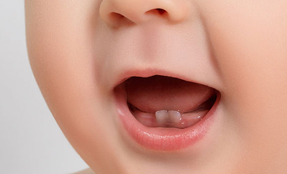 بقع رمادية على أسنان الطفل في الشهر السابع