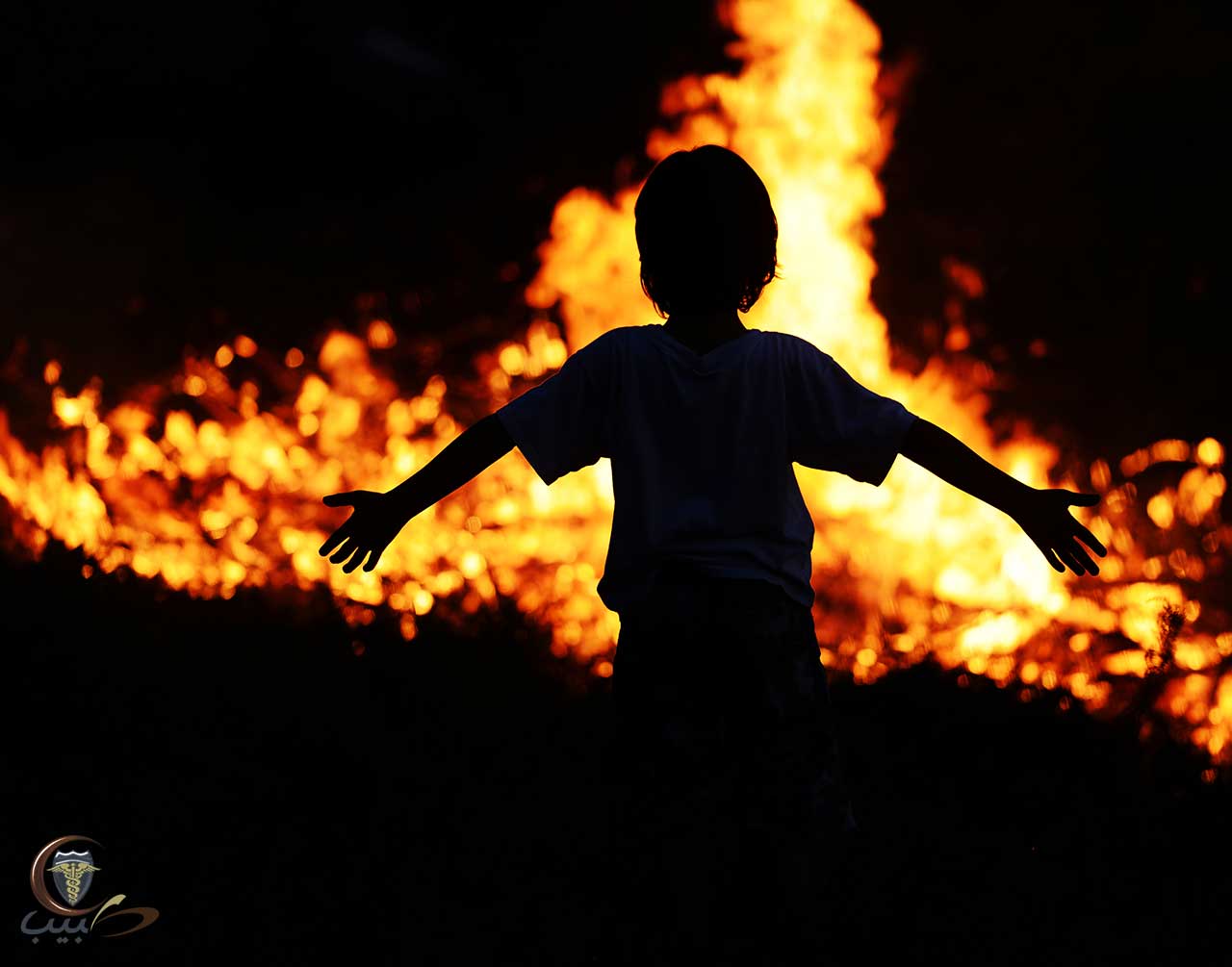 الإسعافات الأولية للطفل في حالة الحروق الحرائق والدخان