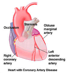 CADheart.gif