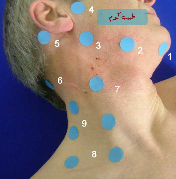 Head%20%26%20neck%20lymph%20nodes%20copy.jpg