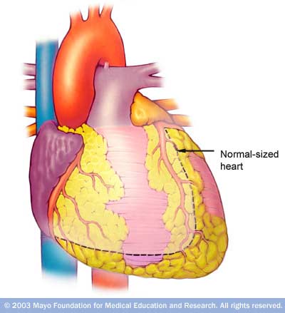 ans7_cardiomegaly.jpg