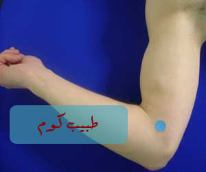 epitrochlear%20copy.jpg