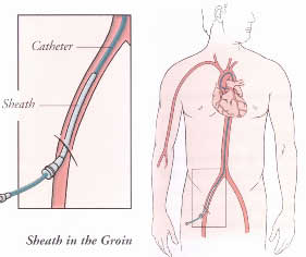 sheath_groin.jpg