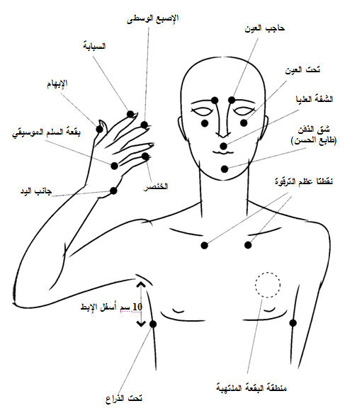 نقر نقاط التوتر