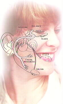 Bell Palsy