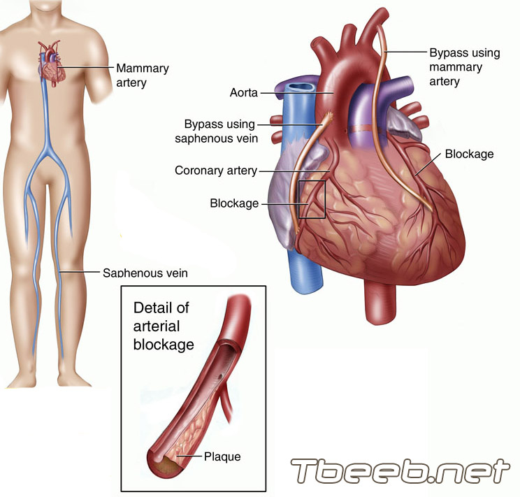 علاج عدم انتظام ضربات القلب اضطرابات نظم القلب Heart Arrhythmias