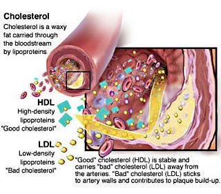 الكوليسترول مرض صامت والوقاية منه خير من العلاج