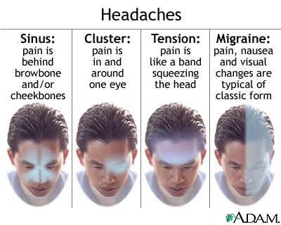 headache type انواع الصداع