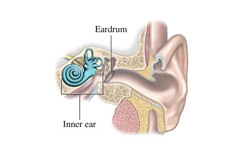 مرض مانيير، داء منيير، دوار أذني المنشأ meniere's disease