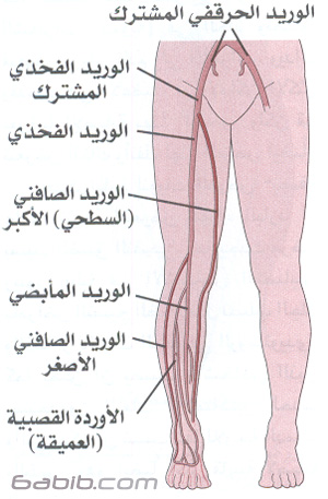 phlebitis