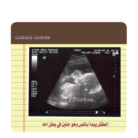 14.gif
