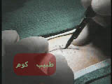 incision%20copy.jpg