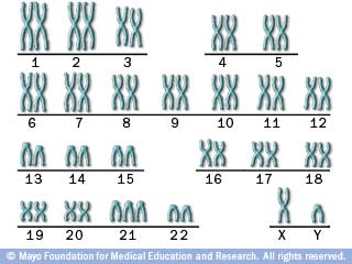 Illustration showing the chromosomes of someone with Down syndrome