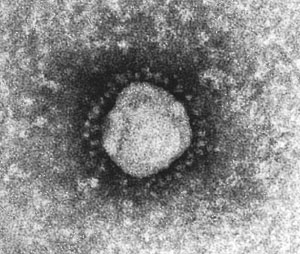 كورونا فيروس coronavirus