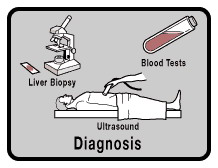 تشخيص التهاب الكبد الفيروسي ج –  الوباء الصامت -  Hepatitis C