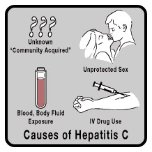اسباب التهاب الكبد الفيروسي ج –  الوباء الصامت -  Hepatitis C