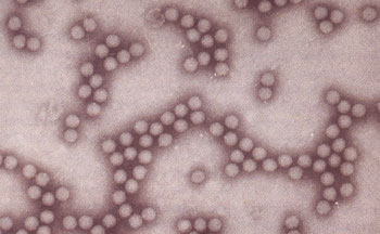 التهاب الكبد الفيروسي أ  (إلتهاب الكبد الوبائي)     Hepatitis A