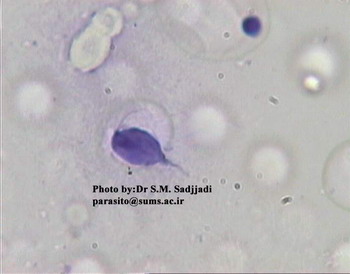 Trichomonas vaginalis